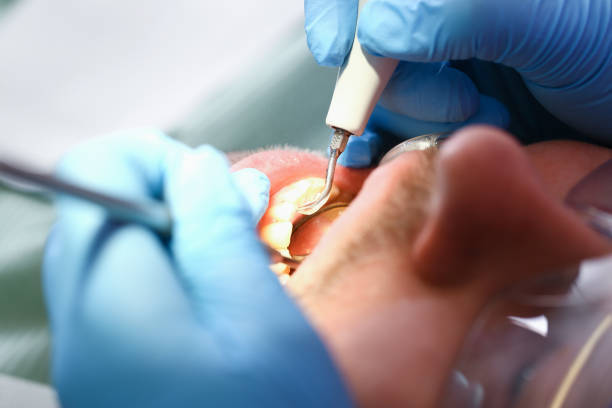 Best Tooth Infection Emergency Dentist  in Waelder, TX